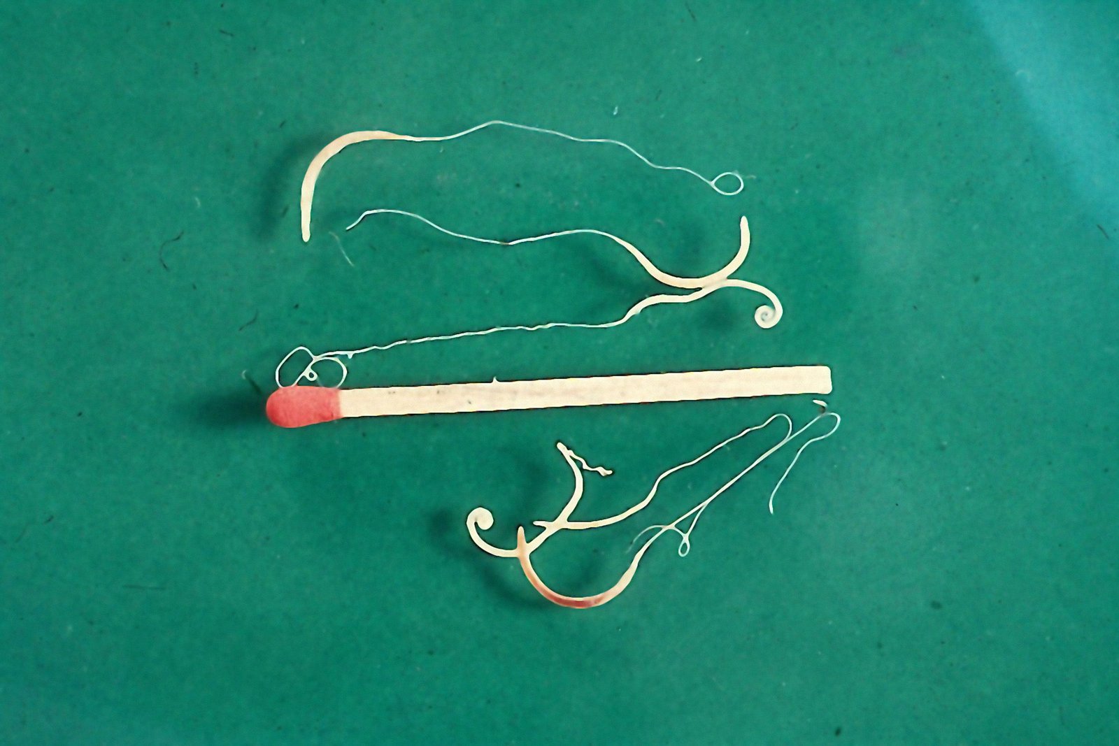 Learn the symptoms, treatment, and prevention of whipworms in dogs.
